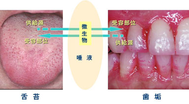 舌苔と歯垢で想定される微生物の受容と供給関係